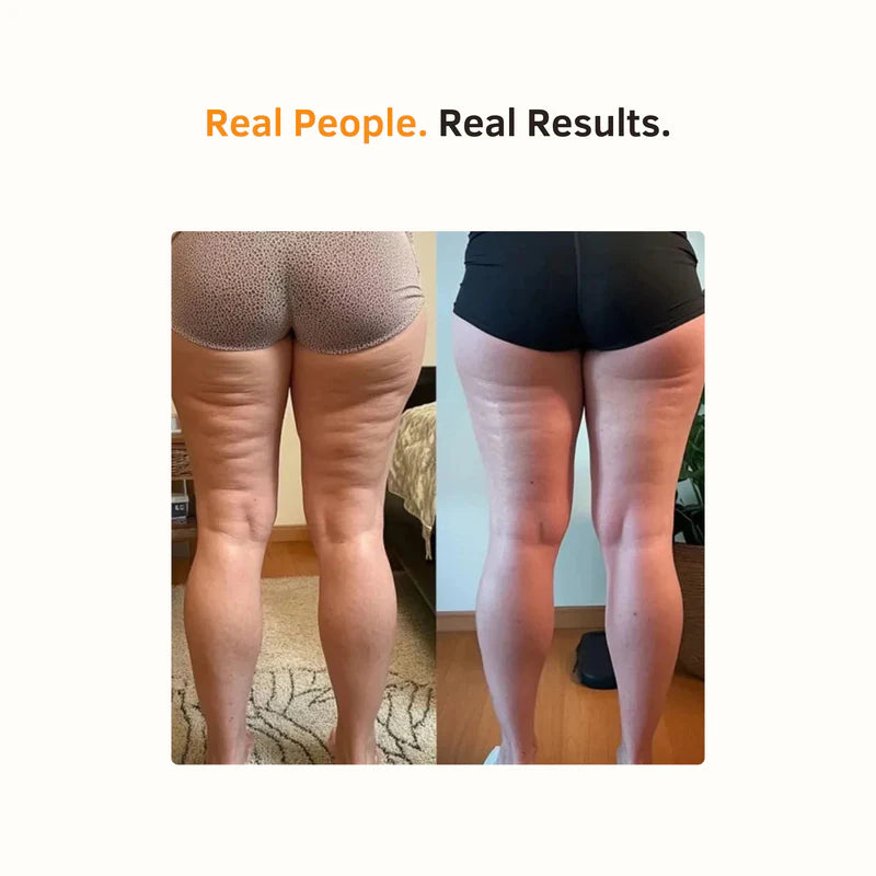 Serivora™ Anti Cellulite Massage Oil
