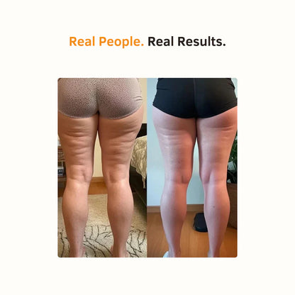 Serivora™ Anti Cellulite Massage Oil